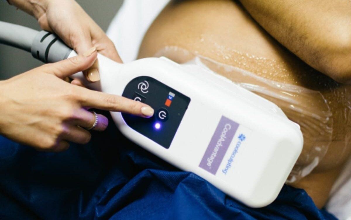 Coolsculpting Benefits