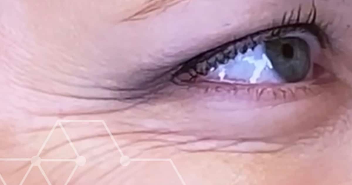 TOP 3 Things to STOP Your Crow’s Feet from Becoming Worse