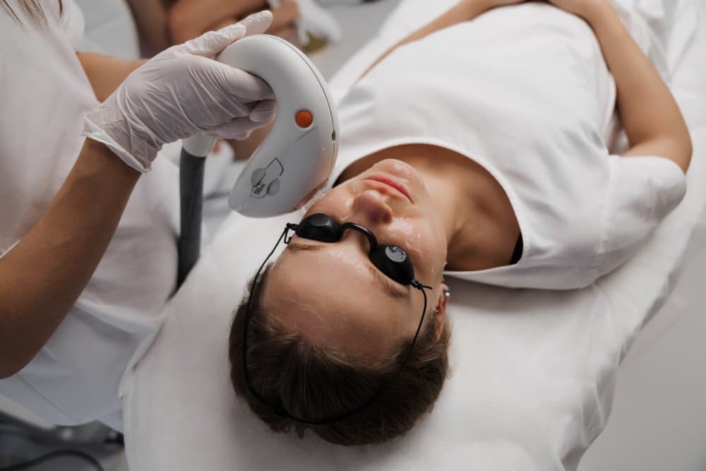 Do IPL Photofacials Work?